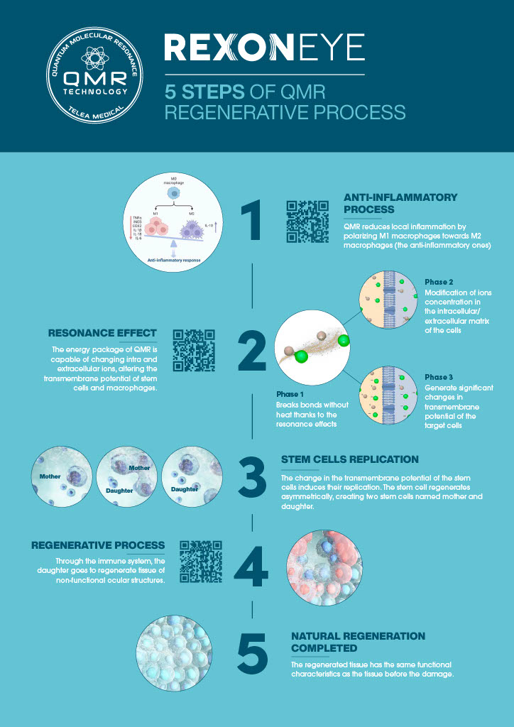 rexon eye qmr infographic